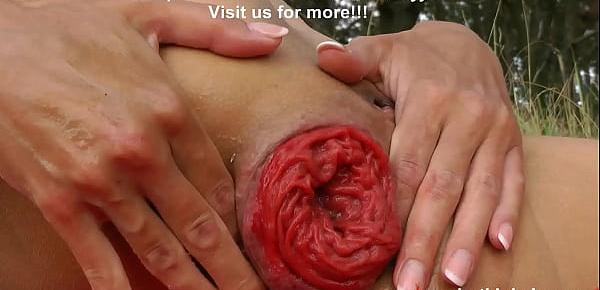  Hotkinkyjo insert big balls in her ass in open public field and prolapse